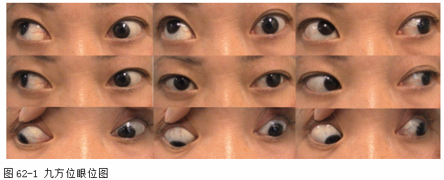 ZY016_318_2.gif